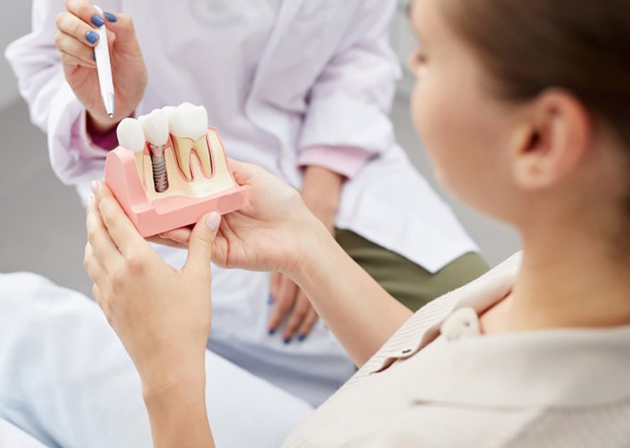 a patient holding a model of a dental implant