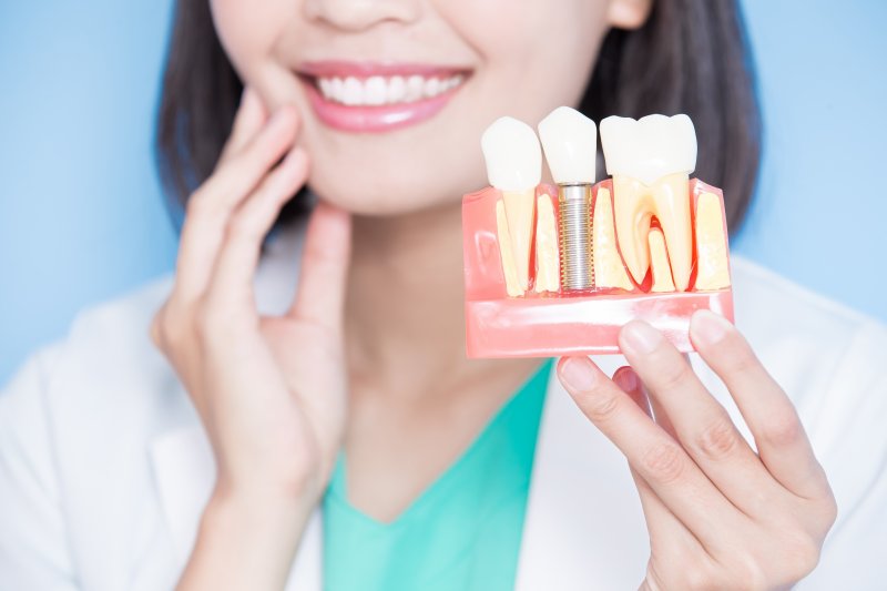 a dentist holding a model of a dental implant